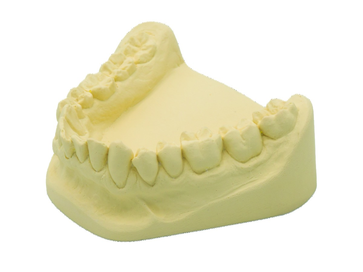 Plâtre Gibraltar CAD/CAM Henry Schein