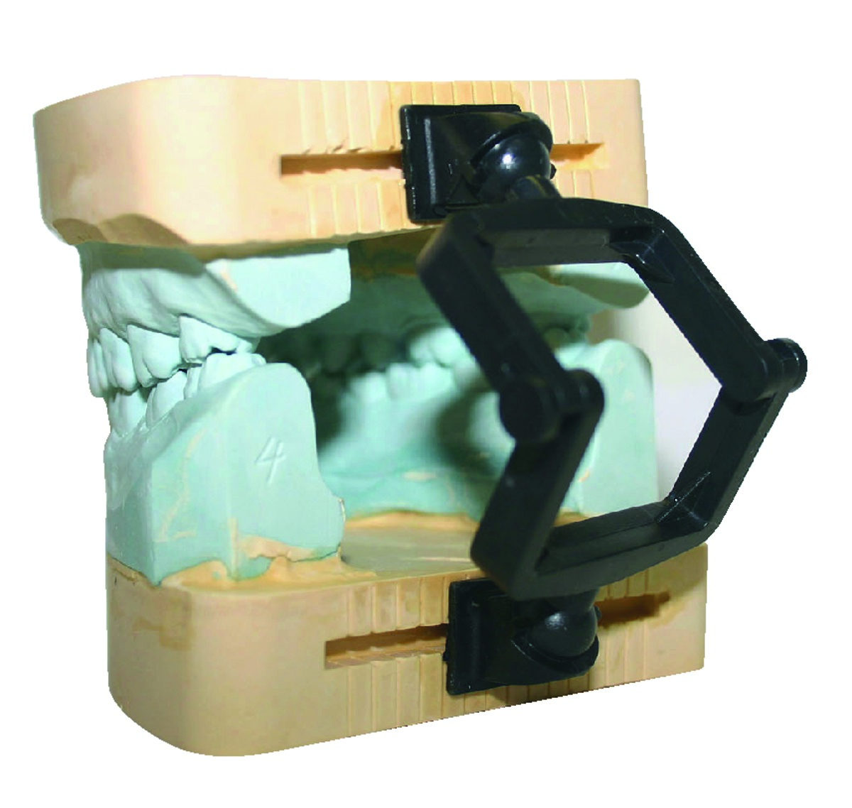 Occluseurs "TYPE VERTEX" - Le sachet de 100 flats - Noirs