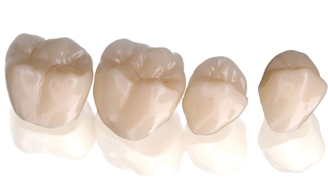 Bloc Zirlux 16+ pré-teinté D2 40 x 19 x 15 le lot de 6